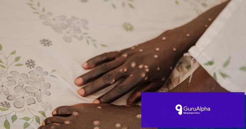 Mpox Reaches Guinea-Bissau as Global Cases Surge Past 190,000