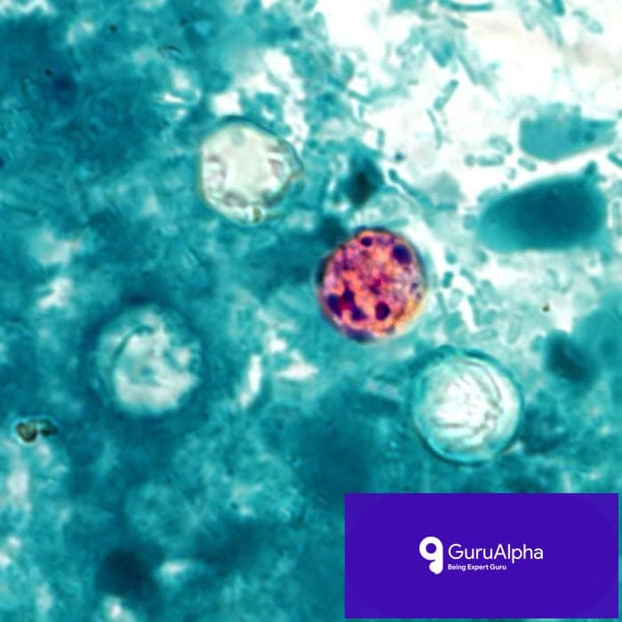 Record Cyclosporiasis Outbreak Strains Weakened US Public Health System