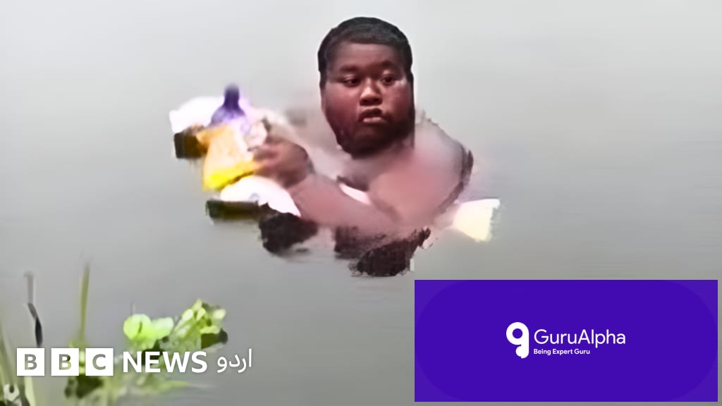 The Boy Who Lives in Water: Iqbal’s Battle With Severe Burning Skin