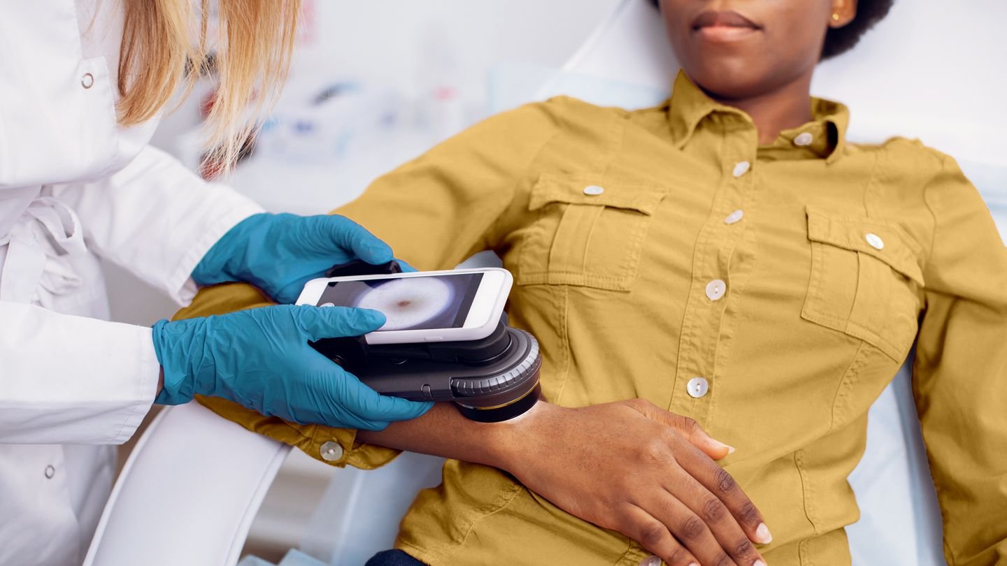 How to Get Better Treatment for Skin Cancer as a Black American