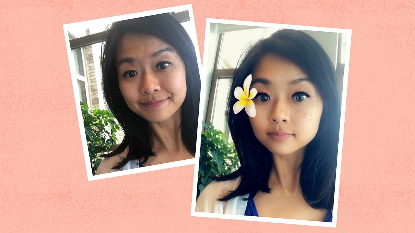 ‘Snapchat Dysmorphia’: Is the Stress of Social Media Driving Young People to Plastic Surgery?